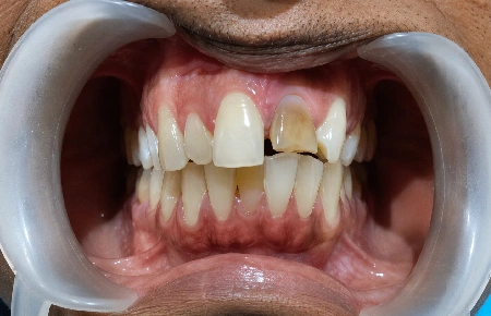 Before dental transformation 9