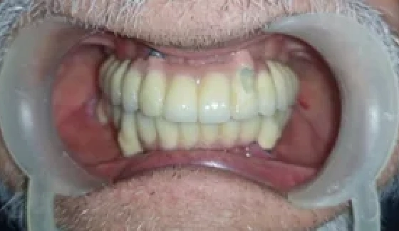 After dental transformation 16