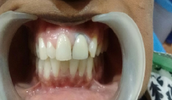 After dental transformation 9