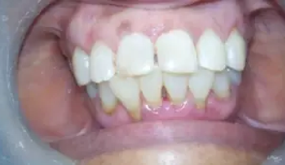 After dental transformation 6
