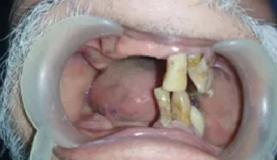Before dental transformation 16