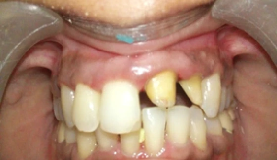 Before dental transformation 10