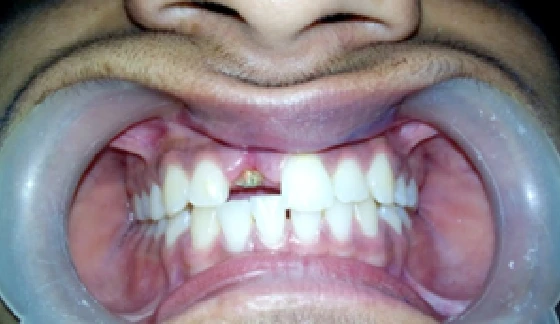 Before dental transformation 11