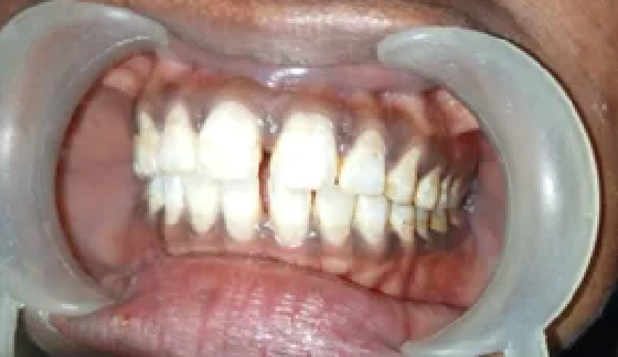 Before dental transformation 15