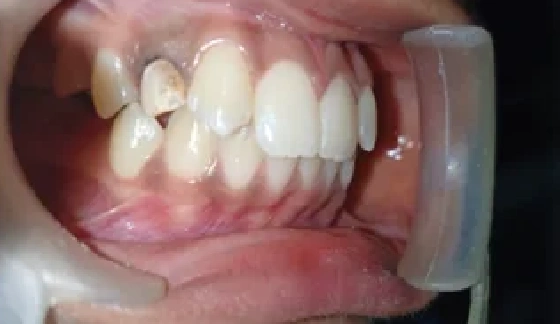 Before dental transformation 17