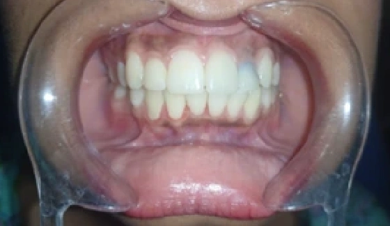 Before dental transformation 18