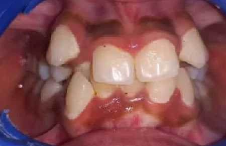 Before dental transformation 3