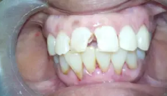 Before dental transformation 6