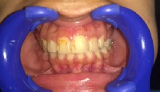 Before dental transformation 7