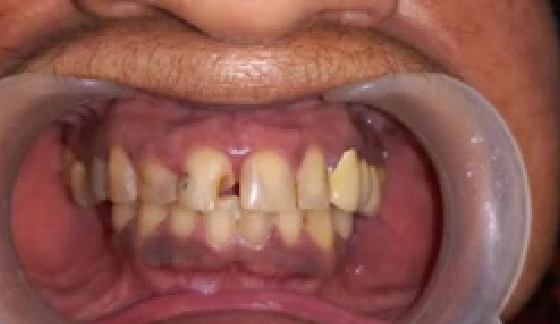 Before dental transformation 8