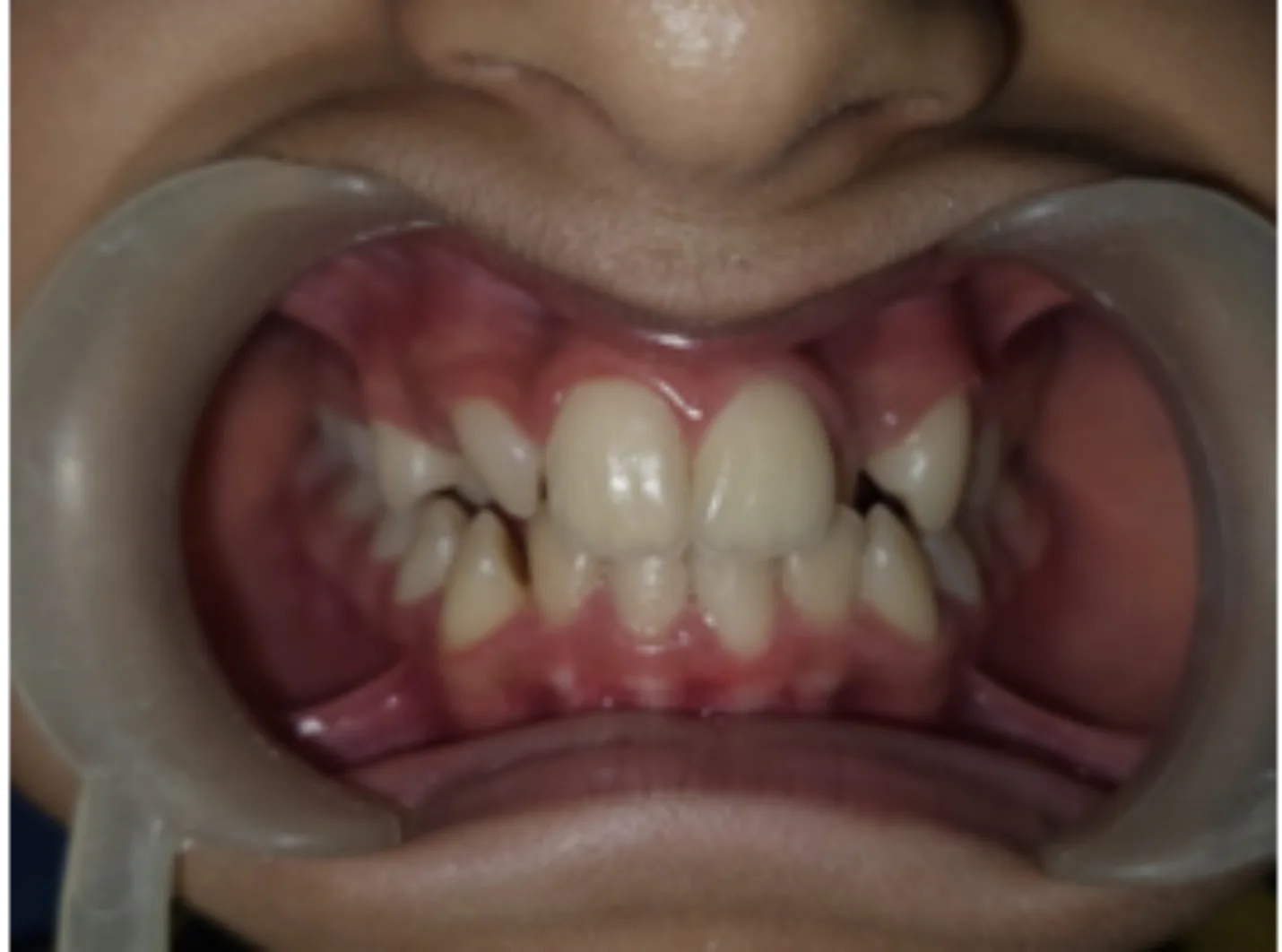 Before dental transformation 2