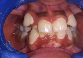 Before dental transformation 3