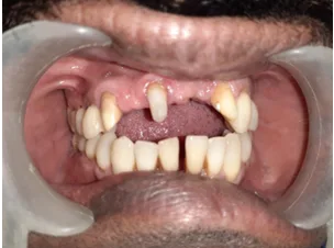 Before dental transformation 5