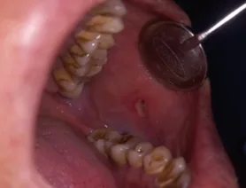 After dental transformation 4