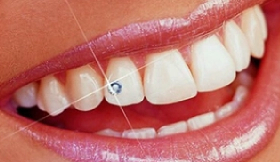 Teeth Jewellery